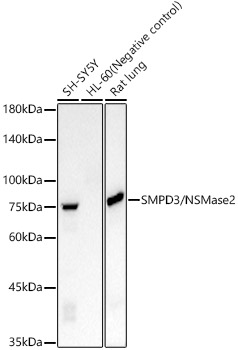 Western blot analysis of various lysates, using SMPD3/NSMase2 Rabbit mAb at 1:2000 dilution.|Secondary antibody: HRP-conjugated Goat anti-Rabbit IgG (H+L) at 1:10000 dilution.|Lysates/proteins: 25μg per lane.|Blocking buffer: 3% nonfat dry milk in TBST.|Detection: ECL Basic Kit.|Exposure time: 5s.