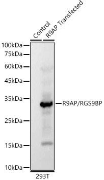 Western blot analysis of extracts from wild type (WT) and 293T cells transfected with R9AP/RGS9BP using R9AP/RGS9BP Rabbit mAb at 1:1000 dilution.|Secondary antibody: HRP-conjugated Goat anti-Rabbit IgG (H+L) at 1:10000 dilution.|Lysates/proteins: 25μg  per lane.|Blocking buffer: 3% nonfat dry milk in TBST.|Detection: ECL Basic Kit.|Exposure time: 1s.