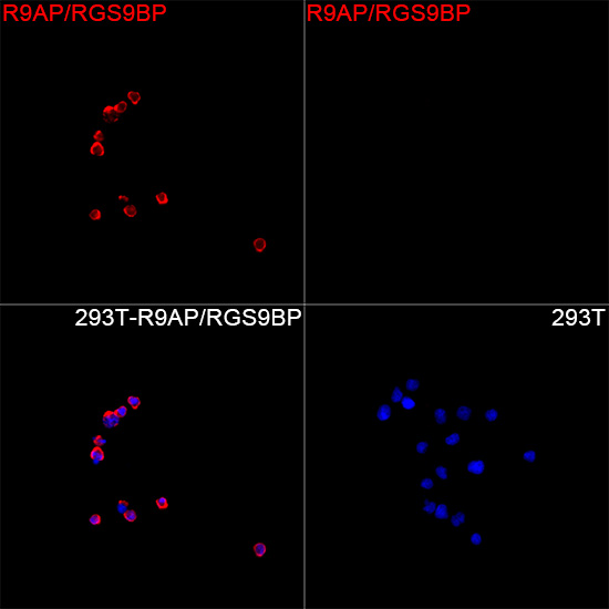 Immunofluorescence analysis of 293T cells transfected with R9AP/RGS9BP using R9AP/RGS9BP Rabbit mAb at a dilution of 1:200 (40x lens). Secondary antibody: Cy3-conjugated Goat anti-Rabbit IgG (H+L) at 1:500 dilution. Blue: DAPI for nuclear staining.