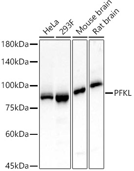 Western blot analysis of various lysates, using PFKL Rabbit mAb at 1:1500 dilution.|Secondary antibody: HRP-conjugated Goat anti-Rabbit IgG (H+L) at 1:10000 dilution.|Lysates/proteins: 25μg per lane.|Blocking buffer: 3% nonfat dry milk in TBST.|Detection: ECL Basic Kit.|Exposure time: 30s.