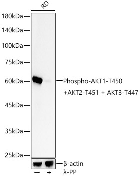 Western blot analysis of lysates from RD cells, using Phospho-AKT1-T450 + AKT2-T451 + AKT3-T447 Rabbit mAb at 1:10000 dilution. RD cells were treated by λ-PP mixed solution (1ul) at 30℃ for 30 minutes.|Secondary antibody: HRP-conjugated Goat anti-Rabbit IgG (H+L) at 1:10000 dilution.|Lysates/proteins: 25μg per lane.|Blocking buffer: 3% nonfat dry milk in TBST.|Detection: ECL Basic Kit.|Exposure time: 30s.