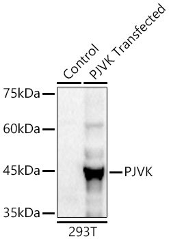 Western blot analysis of lysates from wild type (WT) and 293T cells transfected with PJVK using PJVK Rabbit mAb at 1:1100 dilution incubated overnight at 4℃.|Secondary antibody: HRP-conjugated Goat anti-Rabbit IgG (H+L) at 1:10000 dilution.|Lysates/proteins: 20 μg per lane.|Blocking buffer: 3% nonfat dry milk in TBST.|Detection: ECL Basic Kit.|Exposure time: 45s.|WB samples for antibody validation are kindly provided by Dr. Feng Shao, NIBS
