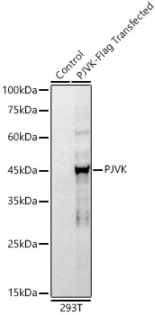 Western blot analysis of lysates from wild type (WT) and 293T cells transfected with PJVK, using PJVK Rabbit mAb at 1:1000 dilution.|Secondary antibody: HRP-conjugated Goat anti-Rabbit IgG (H+L) at 1:10000 dilution.|Lysates/proteins: 25μg per lane.|Blocking buffer: 3% nonfat dry milk in TBST.|Detection: ECL Basic Kit.|Exposure time: 45s.|WB samples for antibody validation are kindly provided by Dr. Feng Shao, NIBS