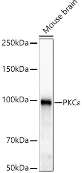 Western blot analysis of lysates from Mouse brain, using PKCε Rabbit mAb at 1:1000 dilution.|Secondary antibody: HRP-conjugated Goat anti-Rabbit IgG (H+L) at 1:10000 dilution.|Lysates/proteins: 25μg per lane.|Blocking buffer: 3% nonfat dry milk in TBST.|Detection: ECL Basic Kit.|Exposure time: 20s.