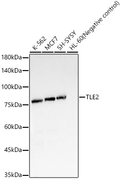 Western blot analysis of various lysates, using TLE2 Rabbit mAb (A23547) at 1:1000 dilution.|Secondary antibody: HRP-conjugated Goat anti-Rabbit IgG (H+L) (AS014) at 1:10000 dilution.|Lysates/proteins: 25μg per lane.|Blocking buffer: 3% nonfat dry milk in TBST.|Detection: ECL Basic Kit (RM00020).|Exposure time: 3s.