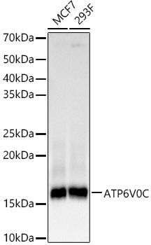 Western blot analysis of various lysates, using ATP6V0C Rabbit mAb at 1:1000 dilution.|Secondary antibody: HRP-conjugated Goat anti-Rabbit IgG (H+L) at 1:10000 dilution.|Lysates/proteins: 25μg per lane.|Blocking buffer: 3% nonfat dry milk in TBST.|Detection: ECL Basic Kit.|Exposure time: 10s.