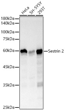Western blot analysis of various lysates, using Sestrin 2 Rabbit mAb at  1:2000 dilution.|Secondary antibody: HRP-conjugated Goat anti-Rabbit IgG (H+L) at 1:10000 dilution.|Lysates/proteins: 25μg per lane.|Blocking buffer: 3% nonfat dry milk in TBST.|Detection: ECL Basic Kit.|Exposure time: 3s.