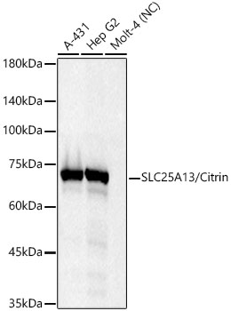 Western blot analysis of various lysates, using SLC25A13/Citrin Rabbit mAb at 1:2000 dilution.|Secondary antibody: HRP-conjugated Goat anti-Rabbit IgG (H+L) at 1:10000 dilution.|Lysates/proteins: 25μg per lane.|Blocking buffer: 3% nonfat dry milk in TBST.|Detection: ECL Basic Kit.|Negative control (NC): MOLT-4|Exposure time: 10s.