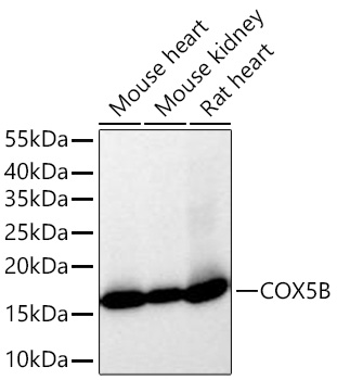 Western blot analysis of various lysates using COX5B Rabbit mAb at 1:14000 dilution incubated overnight at 4℃.|Secondary antibody: HRP-conjugated Goat anti-Rabbit IgG (H+L) at 1:10000 dilution.|Lysates/proteins: 25 μg per lane.|Blocking buffer: 3% nonfat dry milk in TBST.|Detection: ECL Basic Kit.|Exposure time: 1s.