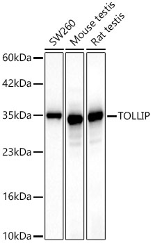 Western blot analysis of various lysates, using [KD Validated] TOLLIP Rabbit mAb (A23780) at 1:1000 dilution.|Secondary antibody: HRP-conjugated Goat anti-Rabbit IgG (H+L) (AS014) at 1:10000 dilution.|Lysates/proteins: 25μg per lane.|Blocking buffer: 3% nonfat dry milk in TBST.|Detection: ECL Basic Kit (RM00020).|Exposure time: 10s.