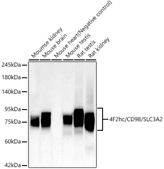 Western blot analysis of various lysates, using 4F2hc/CD98/SLC3A2 Rabbit mAb (A23839) at 1:1000 dilution.|Secondary antibody: HRP-conjugated Goat anti-Rabbit IgG (H+L) (AS014) at 1:10000 dilution.|Lysates/proteins: 25μg per lane.|Blocking buffer: 3% nonfat dry milk in TBST.|Detection: ECL Basic Kit (RM00020).|Exposure time: 90s.