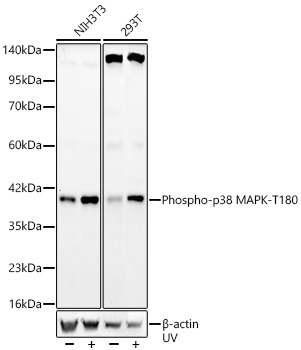 Western blot analysis of various lysates, using Phospho-p38 MAPK-T180 Rabbit mAb at 1:1000 dilution. 293T and NIH3T3 cells were treated with UV at room temperature for 15-30 minutes.|Secondary antibody: HRP-conjugated Goat anti-Rabbit IgG (H+L) at 1:10000 dilution.|Lysates/proteins: 25μg per lane.|Blocking buffer: 3% nonfat dry milk in TBST.|Detection: ECL Basic Kit.|Exposure time: 90s.