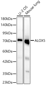 Western blot analysis of various lysates, using ALOX5 Rabbit mAb at 1:1000 dilution.|Secondary antibody: HRP-conjugated Goat anti-Rabbit IgG (H+L) at 1:10000 dilution.|Lysates/proteins: 25μg per lane.|Blocking buffer: 3% nonfat dry milk in TBST.|Detection: ECL Basic Kit.|Exposure time: 90s.