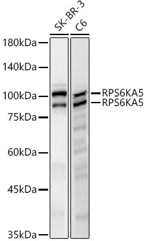 Western blot analysis of various lysates, using RPS6KA5 Rabbit mAb at 1:1000 dilution.|Secondary antibody: HRP-conjugated Goat anti-Rabbit IgG (H+L) at 1:10000 dilution.|Lysates/proteins: 25μg per lane.|Blocking buffer: 3% nonfat dry milk in TBST.|Detection: ECL Basic Kit.|Exposure time: 30s.