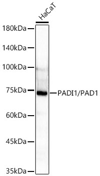 Western blot analysis of lysates from HaCaT cells using PADI1/PAD1 Rabbit mAb at 1:1000 dilution.|Secondary antibody: HRP-conjugated Goat anti-Rabbit IgG (H+L) at 1:10000 dilution.|Lysates/proteins: 25μg per lane.|Blocking buffer: 3% nonfat dry milk in TBST.|Detection: ECL Basic Kit.|Exposure time: 60s.