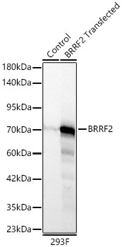 Western blot analysis of lysates from wild type (WT) and 293F cells transfected with BRRF2 using BRRF2 Rabbit mAb at 1:2000 dilution. | Secondary antibody: HRP-conjugated Goat anti-Rabbit IgG (H+L) at 1:10000 dilution. | Lysates/proteins: 25 μg per lane.| Blocking buffer: 3% nonfat dry milk in TBST.| Detection: ECL Basic Kit.| Exposure time: 1s.