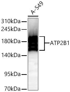 Western blot analysis of lysates from Mouse liver using ATP2B1 Rabbit mAb at 1:2000 dilution incubated overnight at 4℃.|Secondary antibody: HRP-conjugated Goat anti-Rabbit IgG (H+L) at 1:10000 dilution.|Lysates/proteins: 25 μg per lane.|Blocking buffer: 3% nonfat dry milk in TBST.|Detection: ECL Basic Kit.|Exposure time: 45 s.