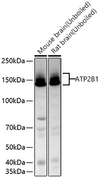 Western blot analysis of various lysates using ATP2B1 Rabbit mAb at 1:12000 dilution incubated overnight at 4℃.|Secondary antibody: HRP-conjugated Goat anti-Rabbit IgG (H+L) at 1:10000 dilution.|Lysates/proteins: 25 μg per lane.|Blocking buffer: 3% nonfat dry milk in TBST.|Detection: ECL Basic Kit.|Exposure time: 5 s.