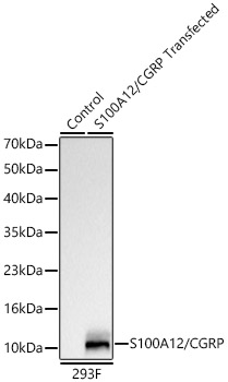 Western blot analysis of lysates from wild type (WT) and 293F cells transfected with S100A12/CGRP, using S100A12/CGRP Rabbit mAb at 1:1000 dilution.|Secondary antibody: HRP-conjugated Goat anti-Rabbit IgG (H+L) at 1:10000 dilution.|Lysates/proteins: 25 μg per lane.|Blocking buffer: 3% nonfat dry milk in TBST.|Detection: ECL Basic Kit.|Exposure time: 10 s.