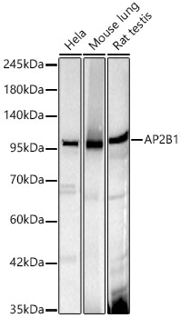 Western blot analysis of various lysates, using AP2B1 Rabbit mAb at 1:1000 dilution.|Secondary antibody: HRP-conjugated Goat anti-Rabbit IgG (H+L) at 1:10000 dilution.|Lysates/proteins: 25μg per lane.|Blocking buffer: 3% nonfat dry milk in TBST.|Detection: ECL Basic Kit.|Exposure time: 10s.