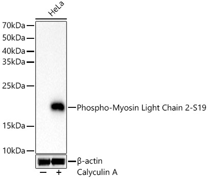 Western blot analysis of lysates from HeLa cells, using Phospho-Myosin Light Chain 2-S19 Rabbit mAb at 1:1000 dilution. HeLa cells were treated with Calyculin A (100 nM) at 37℃ for 30 minutes after serum-starvation overnight.|Secondary antibody: HRP-conjugated Goat anti-Rabbit IgG (H+L) at 1:10000 dilution.|Lysates/proteins: 25μg per lane.|Blocking buffer: 3% nonfat dry milk in TBST.|Detection: ECL Basic Kit.|Exposure time: 10s.