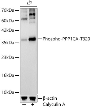 Western blot analysis of various lysates, using Phospho-PPP1CA-T320 Rabbit mAb at 1:2000 dilution. C6 cells were treated with Calyculin A (100 nM) at 37℃ for 30 minutes after serum-starvation overnight.|Secondary antibody: HRP-conjugated Goat anti-Rabbit IgG (H+L) at 1:10000 dilution.|Lysates/proteins: 25μg per lane.|Blocking buffer: 3% nonfat dry milk in TBST.|Detection: ECL Basic Kit.|Exposure time: 20s.