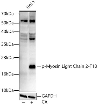 Western blot analysis of lysates from HeLa cells, using Phospho-Myosin Light Chain 2-T18 Rabbit mAb at 1:1000 dilution. HeLa cells were treated with Calyculin A (100 nM) at 37℃ for 30 minutes after serum-starvation overnight.|Secondary antibody: HRP-conjugated Goat anti-Rabbit IgG (H+L) at 1:10000 dilution.|Lysates/proteins: 25μg per lane.|Blocking buffer: 3% nonfat dry milk in TBST.|Detection: ECL Enhanced Kit.|Exposure time: 90s.