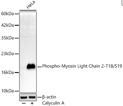 Western blot analysis of lysates from HeLa cells, using Phospho-Myosin Light Chain 2-T18/S19 Rabbit mAb at 1:6000 dilution.|Secondary antibody: HRP-conjugated Goat anti-Rabbit IgG (H+L) at 1:10000 dilution.|Lysates/proteins: 25μg per lane.|Blocking buffer: 3% nonfat dry milk in TBST.|Detection: ECL Basic Kit.|Exposure time: 30s.