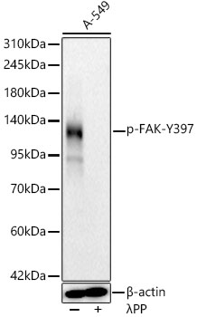 Western blot analysis of lysates from A-549 cells, using Phospho-FAK-Y397 Rabbit mAb at 1:4000 dilution. A-549 cells were treated by λ-PP mixed solution (1ul) at 30℃ for 30 minutes.|Secondary antibody: HRP-conjugated Goat anti-Rabbit IgG (H+L) at 1:10000 dilution.|Lysates/proteins: 25μg per lane.|Blocking buffer: 3% nonfat dry milk in TBST.|Detection: ECL Basic Kit.|Exposure time: 30s.