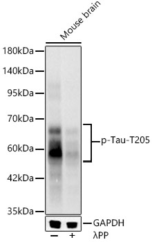 Western blot analysis of lysates from Mouse brain, using Phospho-Tau-T205 Rabbit mAb at 1:1000 dilution.|Secondary antibody: HRP-conjugated Goat anti-Rabbit IgG (H+L) at 1:10000 dilution.|Lysates/proteins: 25μg per lane.|Blocking buffer: 3% nonfat dry milk in TBST.|Detection: ECL Basic Kit.|Exposure time: 20s.