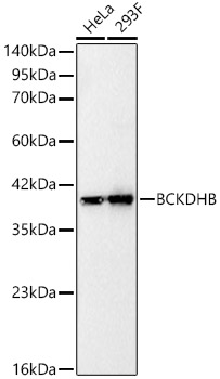 Western blot analysis of various lysates, using BCKDHB Rabbit mAb at 1:2000 dilution.|Secondary antibody: HRP-conjugated Goat anti-Rabbit IgG (H+L) at 1:10000 dilution.|Lysates/proteins: 25μg per lane.|Blocking buffer: 3% nonfat dry milk in TBST.|Detection: ECL Basic Kit.|Exposure time: 0.5s.