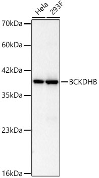 Western blot analysis of various lysates, using BCKDHB Rabbit mAb at 1:2000 dilution.|Secondary antibody: HRP-conjugated Goat anti-Rabbit IgG (H+L) at 1:10000 dilution.|Lysates/proteins: 25μg per lane.|Blocking buffer: 3% nonfat dry milk in TBST.|Detection: ECL Basic Kit.|Exposure time: 10s.