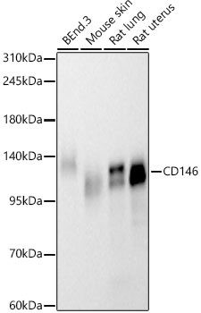 Western blot analysis of various lysates, using CD146 Rabbit mAb at 1:1000 dilution.|Secondary antibody: HRP-conjugated Goat anti-Rabbit IgG (H+L) at 1:10000 dilution.|Lysates/proteins: 25μg per lane.|Blocking buffer: 3% nonfat dry milk in TBST.|Detection: ECL Basic Kit.|Exposure time: 60s.