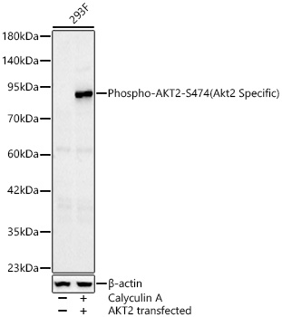 Western blot analysis of lysates from wild type (WT) and 293F cells transfected with AKT2 using Phospho-AKT2-S474 Rabbit mAb at 1:1000 dilution. AKT2 transfected 293F cells were treated with Calyculin A (100 nM) at 37℃ for 30 minutes after serum-starvation overnight.|Secondary antibody: HRP-conjugated Goat anti-Rabbit IgG (H+L) at 1:10000 dilution.|Lysates/proteins: 25μg per lane.|Blocking buffer: 3% nonfat dry milk in TBST.|Detection: ECL Basic Kit.|Exposure time: 30s.