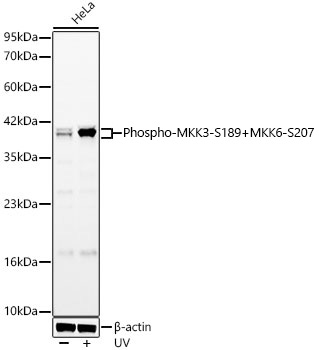Western blot analysis of lysates from HeLa cells, using Phospho-MKK3-S189+MKK6-S207 Rabbit mAb at 1:1000 dilution. HeLa cells were treated with UV at room temperature for 15-30 minutes.|Secondary antibody: HRP-conjugated Goat anti-Rabbit IgG (H+L) at 1:10000 dilution.|Lysates/proteins: 25μg per lane.|Blocking buffer: 3% nonfat dry milk in TBST.|Detection: ECL Basic Kit.|Exposure time: 180s.