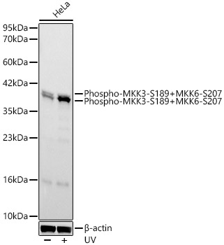 Western blot analysis of lysates from HeLa cells, using Phospho-MKK3-S189+MKK6-S207 Rabbit mAb at 1:1000 dilution. HeLa cells were treated with UV at room temperature for 15-30 minutes.|Secondary antibody: HRP-conjugated Goat anti-Rabbit IgG (H+L) at 1:10000 dilution.|Lysates/proteins: 25μg per lane.|Blocking buffer: 3% nonfat dry milk in TBST.|Detection: ECL Basic Kit.|Exposure time: 180s.
