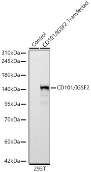 Western blot analysis of lysates from normal 293T cells and 293T transfected with CD101/IGSF2 protein, using CD101/IGSF2 Rabbit mAb at 1:1000 dilution.|Secondary antibody: HRP-conjugated Goat anti-Rabbit IgG (H+L) at 1:10000 dilution.|Lysates/proteins: 25μg per lane.|Blocking buffer: 3% nonfat dry milk in TBST.|Detection: ECL Basic Kit.|Exposure time: 10s.