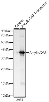 Western blot analysis of lysates from lysates from wild type (WT) and 293T cells transfected with Amylin/DAP using Amylin/DAP Rabbit mAb at 1:2000 dilution.|Secondary antibody: HRP-conjugated Goat anti-Rabbit IgG (H+L) at 1:10000 dilution.|Lysates/proteins: 25μg per lane.|Blocking buffer: 3% nonfat dry milk in TBST.|Detection: ECL Basic Kit.|Exposure time: 5s.