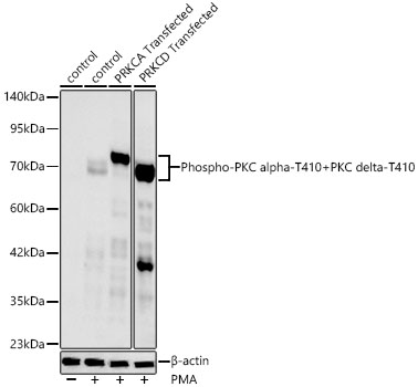 Western blot analysis of lysates from wild type (WT)、 293F cells were treated with PMA、293F cells were treated with PMA after transfected with PRKCA and 293F cells were treated with PMA after transfected with PRKCD using Phospho-PKC alpha-T410+PKC delta-T410 Rabbit mAb at 1:2000 dilution. 293F、293F-PRKCA-Transfected and 293F-PRKCD-Transfected cells were treated with PMA (200 nM) at 37℃ for 30 minutes.|Secondary antibody: HRP-conjugated Goat anti-Rabbit IgG (H+L) at 1:10000 dilution.|Lysates/proteins: 25μg per lane.|Blocking buffer: 3% nonfat dry milk in TBST.|Detection: ECL Basic Kit.|Exposure time: 90s.