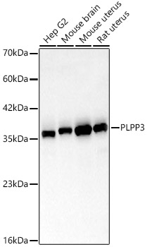 Western blot analysis of various lysates, using PLPP3 Rabbit mAb at 1:1000 dilution.|Secondary antibody: HRP-conjugated Goat anti-Rabbit IgG (H+L) at 1:10000 dilution.|Lysates/proteins: 25μg per lane.|Blocking buffer: 3% nonfat dry milk in TBST.|Detection: ECL Basic Kit.|Exposure time: 30s.