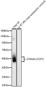 Western blot analysis of lysates from Hep G2 cells, using ST6GAL1/CD75 Rabbit mAb at 1:7000 dilution.|Secondary antibody: HRP-conjugated Goat anti-Rabbit IgG (H+L) at 1:10000 dilution.|Lysates/proteins: 25μg per lane.|Blocking buffer: 3% nonfat dry milk in TBST.|Detection: ECL Basic Kit.|Exposure time: 90s.