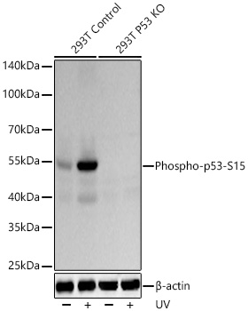 Western blot analysis of lysates from wild type (WT) and p53 knockout (KO) 293T cells using [KO Validated] Phospho-p53-S15 Rabbit mAb at 1:3000  dilution incubated overnight at 4℃. 293T cells and P53 knockout (KO) 293T cells were treated with UV at room temperature for 15-30 minutes.|Secondary antibody: HRP-conjugated Goat anti-Rabbit IgG (H+L) at 1:10000 dilution.|Lysates/proteins: 30 μg per lane.|Blocking buffer: 3% nonfat dry milk in TBST.|Detection: ECL Basic Kit.|Exposure time: 30 s.