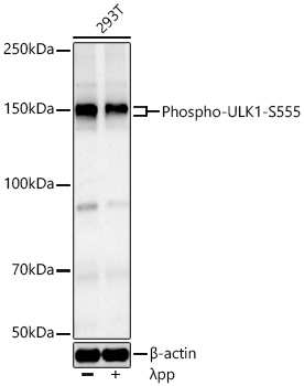 Western blot analysis of lysates from 293T cells using Phospho-ULK1-S555 Rabbit mAb at 1:8000 dilution incubated overnight at 4℃. 293T cells were treated by λ-PP mixed solution (62.5U) at 30℃ for 1 hours. | Secondary antibody: HRP-conjugated Goat anti-Rabbit IgG (H+L) at 1:10000 dilution.|Lysates/proteins: 30 μg per lane.| Blocking buffer: 3% nonfat dry milk in TBST.| Detection: ECL Basic Kit.| Exposure time: 45s.