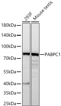 Western blot analysis of various lysates using PABPC1 Rabbit mAb at 1:5000 dilution incubated overnight at 4℃.|Secondary antibody: HRP-conjugated Goat anti-Rabbit IgG (H+L) at 1:10000 dilution.|Lysates/proteins: 25 μg per lane.|Blocking buffer: 3% nonfat dry milk in TBST.|Detection: ECL Basic Kit.|Exposure time: 1s.