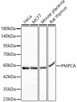 Western blot analysis of various lysates, using PMPCA Rabbit mAb at 1:4000 dilution.|Secondary antibody: HRP-conjugated Goat anti-Rabbit IgG (H+L) at 1:10000 dilution.|Lysates/proteins: 25μg per lane.|Blocking buffer: 3% nonfat dry milk in TBST.|Detection: ECL Basic Kit.|Exposure time: 1s.