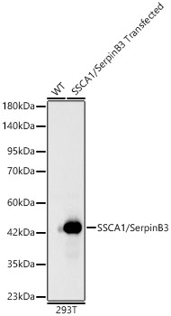 Western blot analysis of lysates from wild type (WT) and 293T cells transfected with SSCA1/SerpinB3, using SSCA1/SerpinB3 Rabbit mAb at 1:9000 dilution.|Secondary antibody: HRP-conjugated Goat anti-Rabbit IgG (H+L) at 1:10000 dilution.|Lysates/proteins: 25μg per lane.|Blocking buffer: 3% nonfat dry milk in TBST.|Detection: ECL Basic Kit.|Exposure time: 10s.