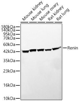 Western blot analysis of various lysates, using Renin Rabbit mAb at 1:5000 dilution.|Secondary antibody: HRP-conjugated Goat anti-Rabbit IgG (H+L) at 1:10000 dilution.|Lysates/proteins: 25μg per lane.|Blocking buffer: 3% nonfat dry milk in TBST.|Detection: ECL Basic Kit.|Exposure time: 45s.