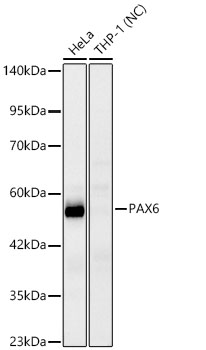 Western blot analysis of various lysates using PAX6 Rabbit mAb at 1:1000 dilution.|Secondary antibody: HRP-conjugated Goat anti-Rabbit IgG (H+L) at 1:10000 dilution.|Lysates/proteins: 25 μg per lane.|Blocking buffer: 3% nonfat dry milk in TBST.|Detection: ECL Basic Kit.|Negative control (NC): THP-1.|Exposure time: 90s.