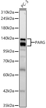 Western blot analysis of lysates from PC-3 cells, using PARG Rabbit mAb at 1:2000 dilution.|Secondary antibody: HRP-conjugated Goat anti-Rabbit IgG (H+L) at 1:10000 dilution.|Lysates/proteins: 25μg per lane.|Blocking buffer: 3% nonfat dry milk in TBST.|Detection: ECL Basic Kit.|Exposure time: 30s.