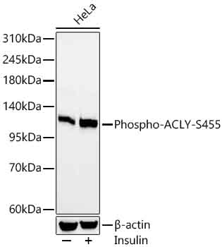 Western blot analysis of lysates from HeLa cells using Phospho-ACLY-S455 Rabbit mAb at 1:1000 dilution. HeLa cells were treated with Insulin (50 nM) at 37℃ for 30 minutes after serum-starvation overnight.|Secondary antibody: HRP-conjugated Goat anti-Rabbit IgG (H+L) at 1:10000 dilution.|Lysates/proteins: 25 μg per lane.|Blocking buffer: 3% nonfat dry milk in TBST.|Detection: ECL Basic Kit.|Exposure time: 20s.